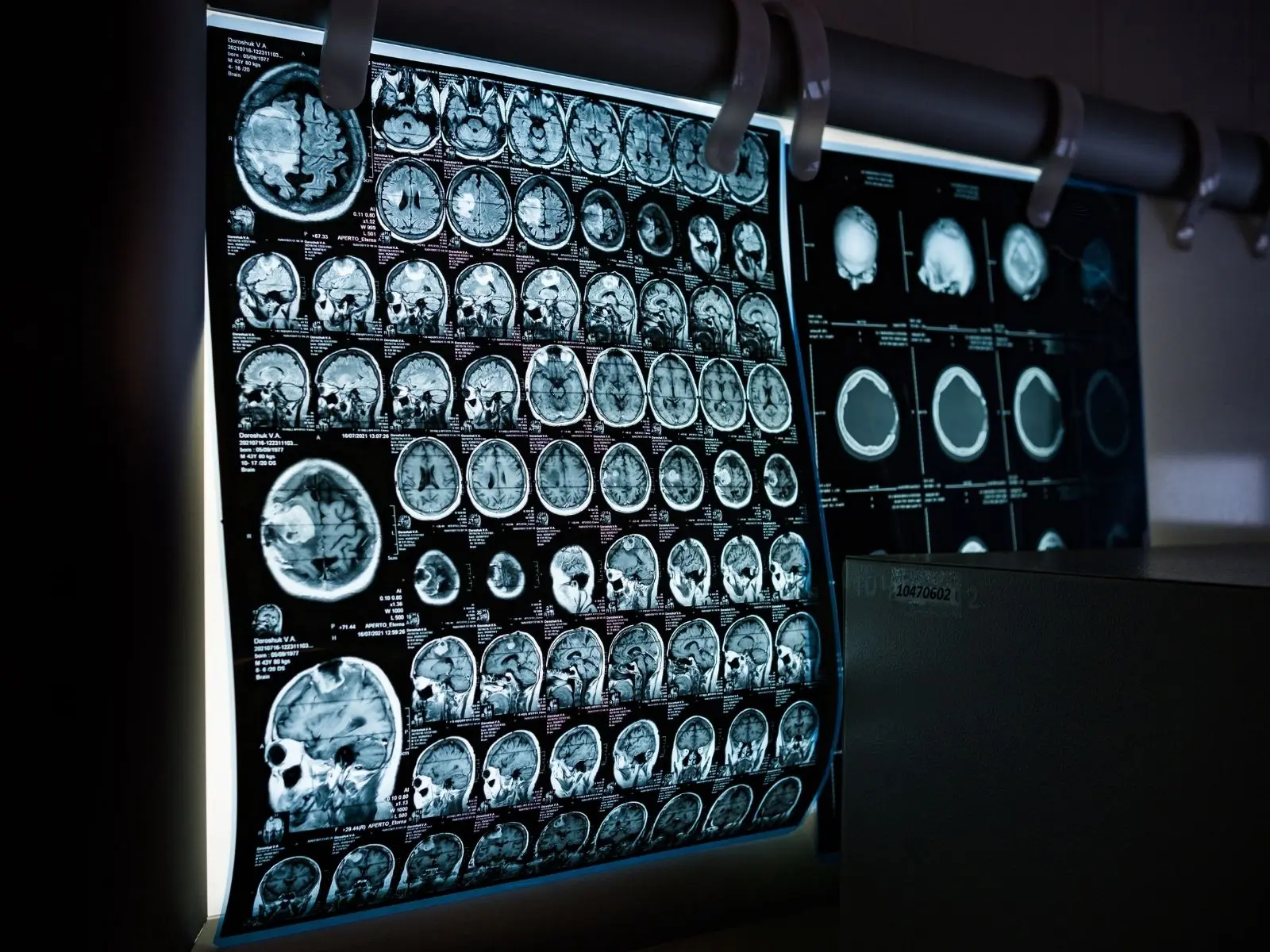 Lo que le ocurre a tu cerebro tras pasar 28 horas despierto y el hallazgo científico sobre las sinapsis