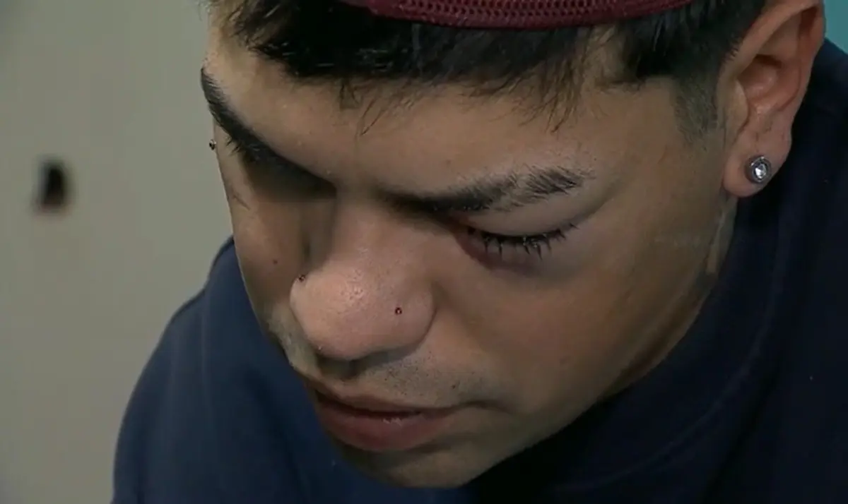 Habló el joven herido tras un operativo en el Parque Rivera: “El ojo está muy lastimado”
