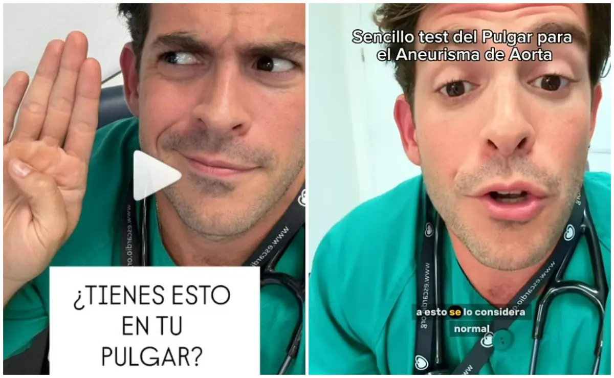 Literalmente a mano: cardiólogo comparte “test del pulgar” para prever riesgo de aneurisma