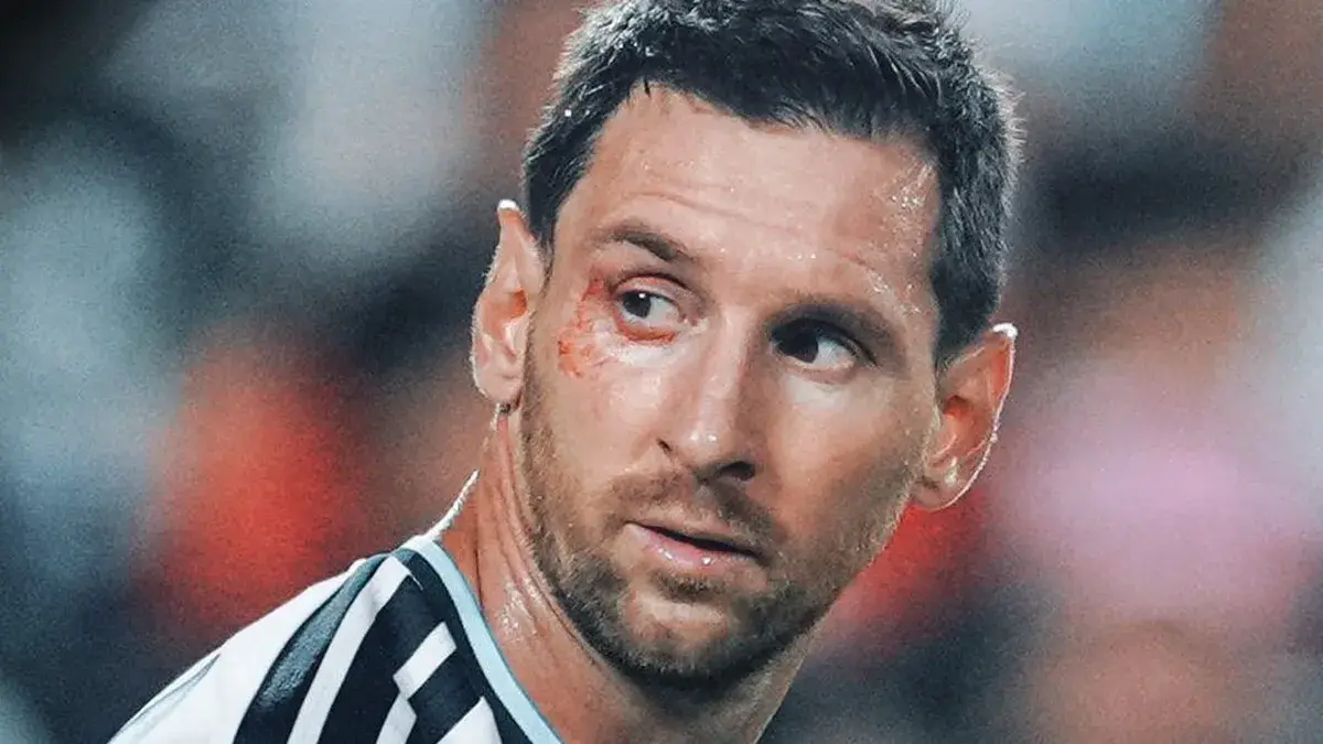 Qué le pasó a Lionel Messi en el ojo: el capitán recibió atención en medio del partido Argentina vs Suiza en el Mundial 2026