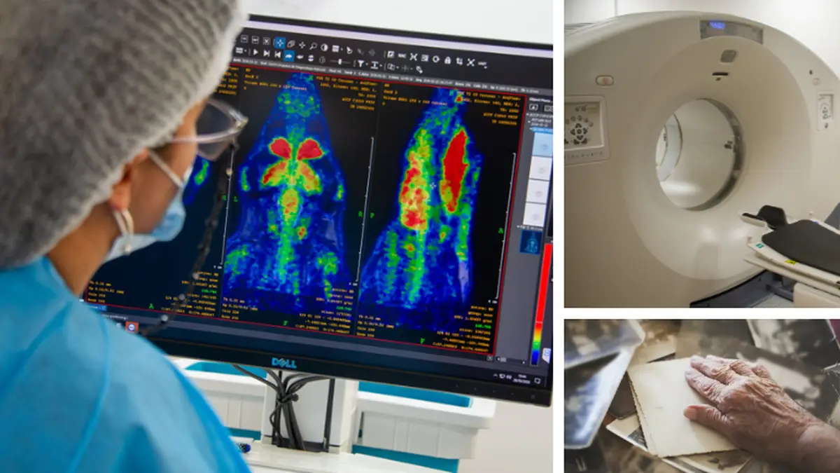 La carrera contra el olvido: científicos uruguayos dan un paso clave para detectar antes el Alzheimer