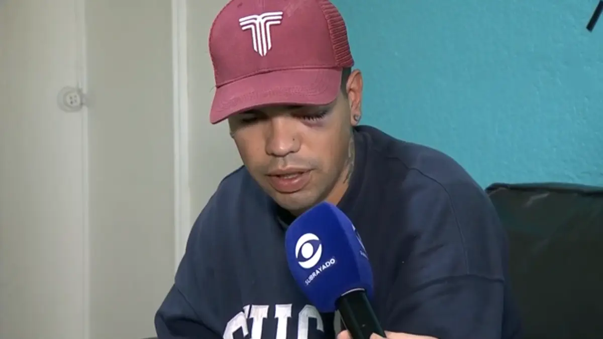 Niño herido en operativo policial contra picadas en Parque Rivera