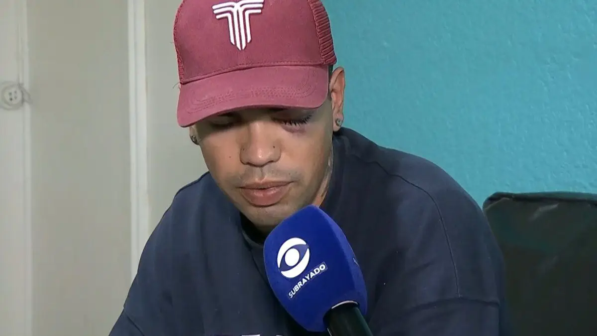 Joven recibió impacto de bala en un ojo durante operativo policial en Parque Rivera: “Se ensañó conmigo”